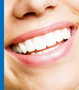 Read more about the article Whiten Your Smile